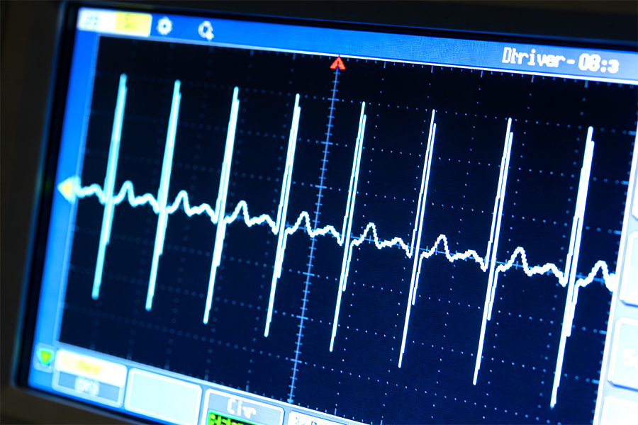 Inkjet printer manufacturer proprietary waveform control and drive circuit R&D